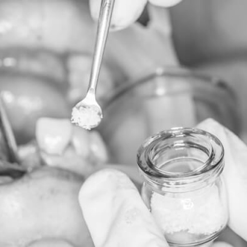 Knochenersatzmaterial - ZahnarztAubing Dr. Johannes Stern